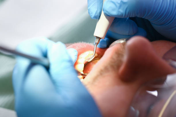  Cordova, NC Emergency Dentist Pros