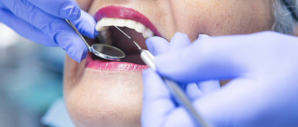 Best Emergency Treatment for Dental Infections or Abscesses in Cordova, NC